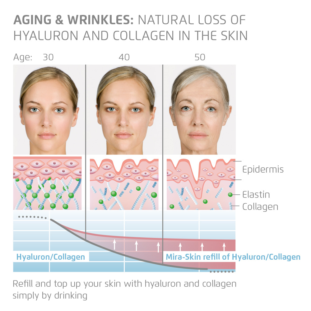 Natural loss of Hyláluron and Collagen in the skin by ageing
